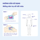 /upload/product/mieng-dan/mieng-dan-ha-sot-doi-mau-091.webp