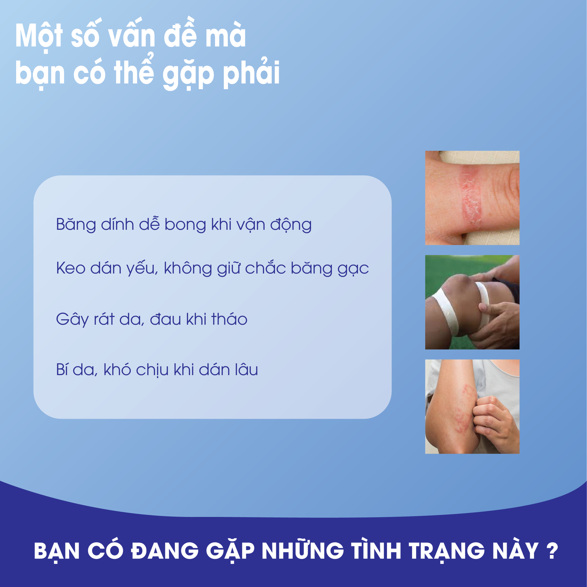 Băng Dính Cuộn Vải Lụa Y Tế Suremed BH245173 4
