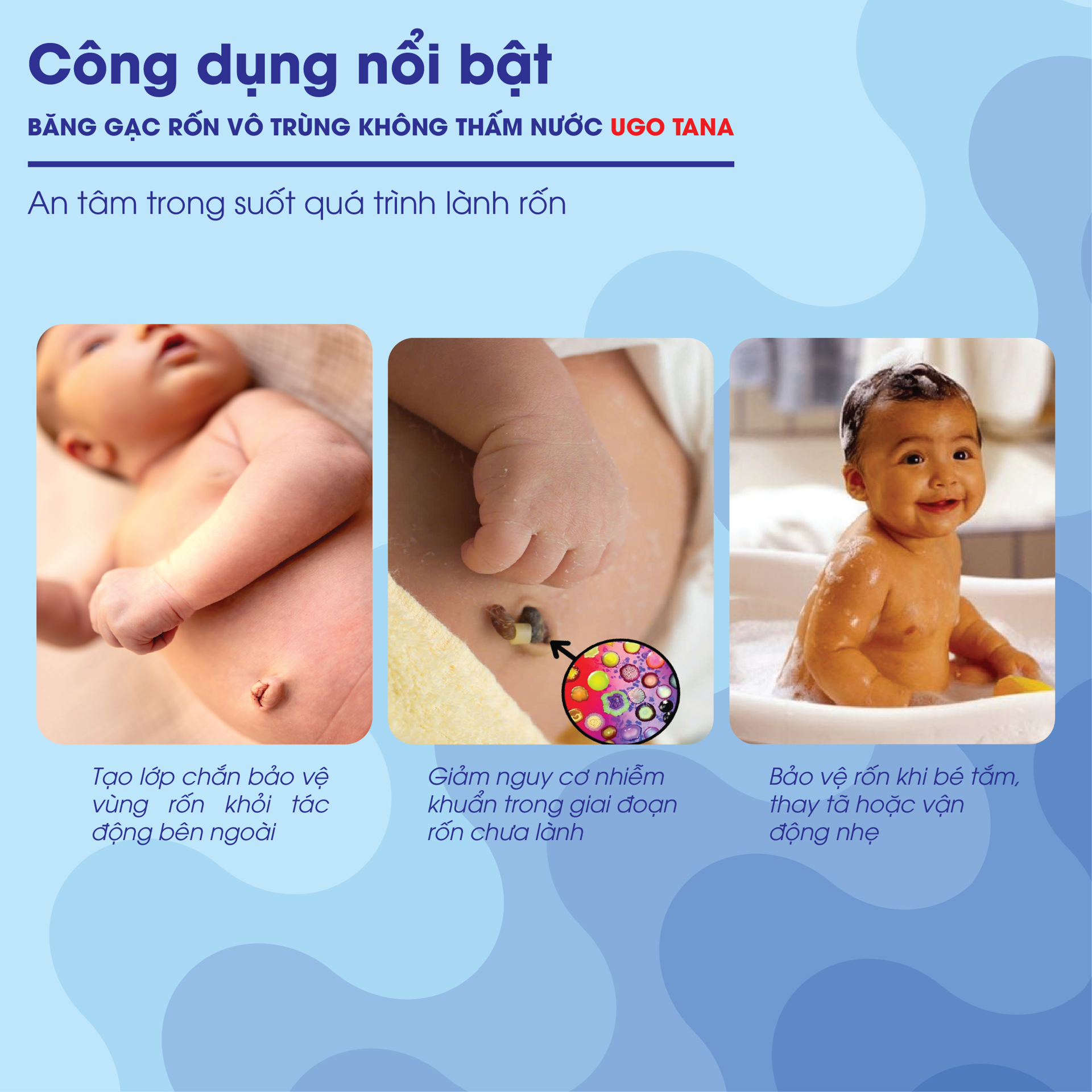 Băng gạc rốn vô trùng không thấm nước UGOTANA BH245146 1