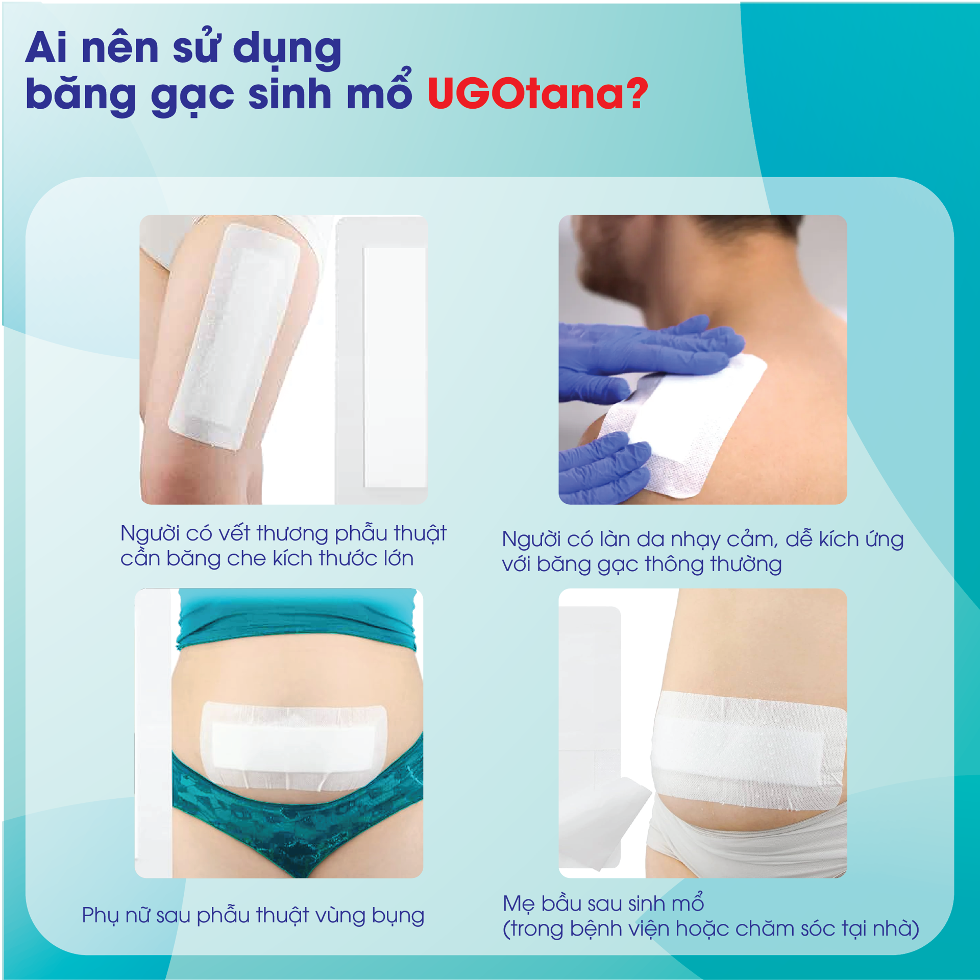 Băng Gạc Sinh Mổ Vô Trùng Ugotana BH245147 2