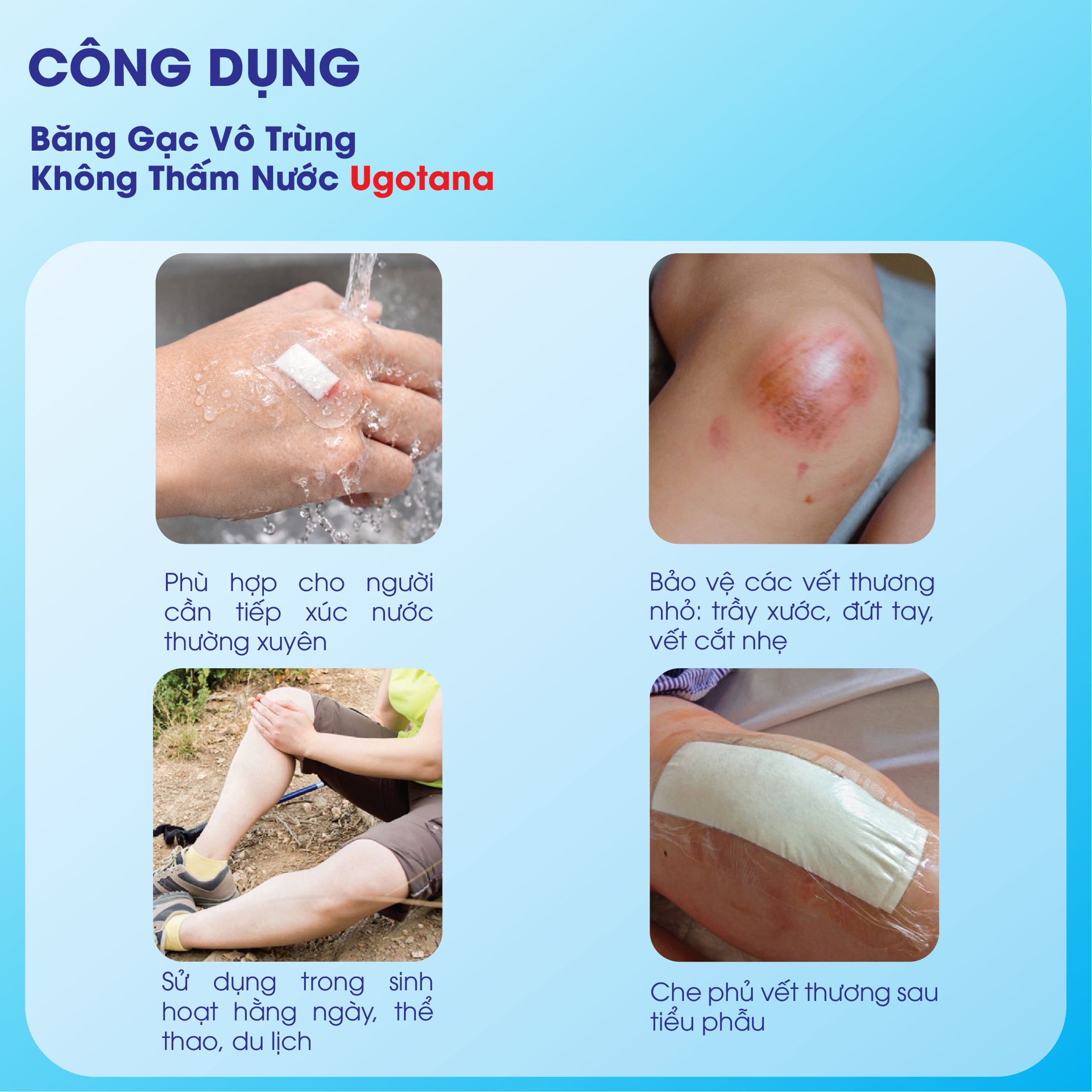 Băng Gạc Vô Trùng Không Thấm Nước Ugotana BH245144 2