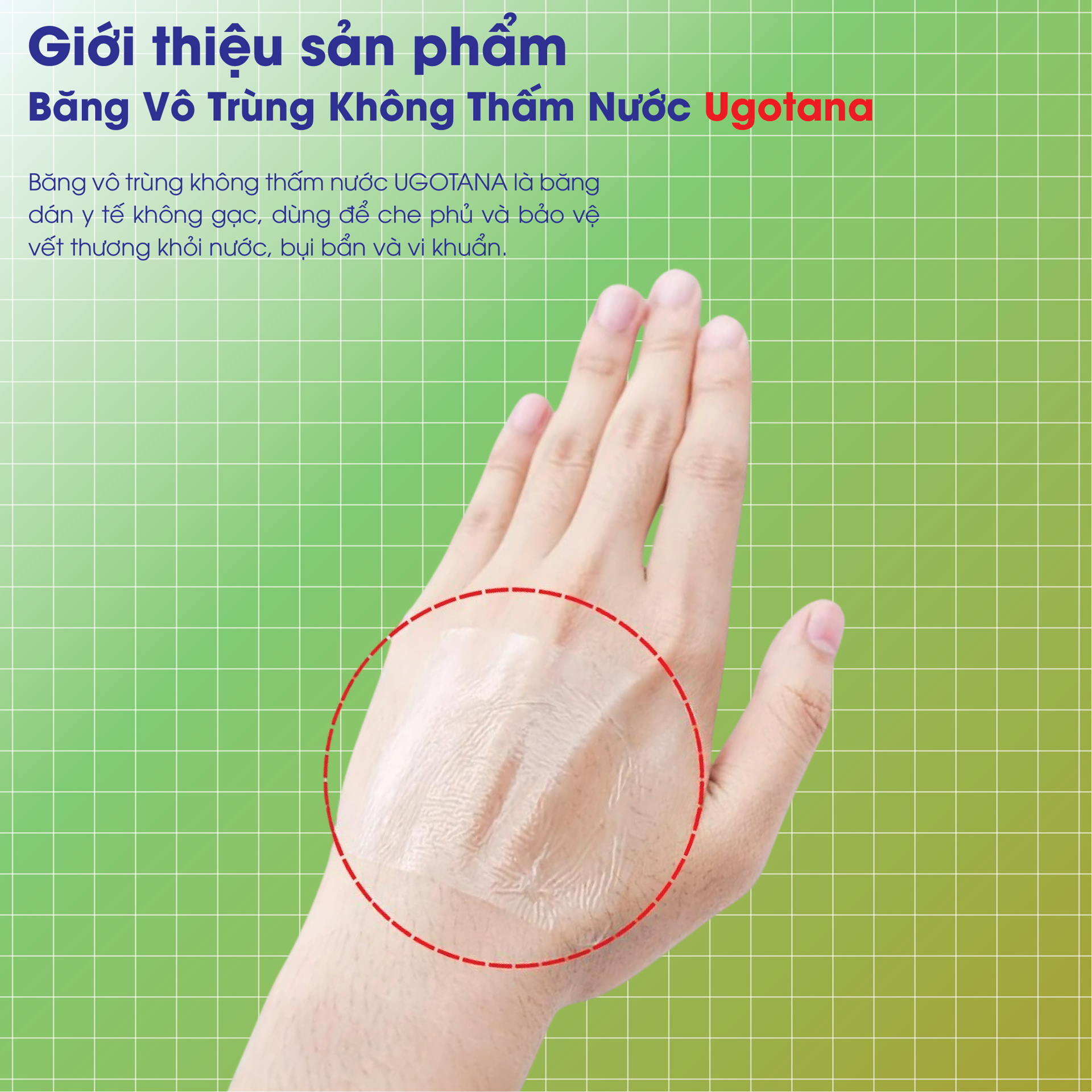 Băng Vô Trùng Không Thấm Nước Ugotana BH245145 1