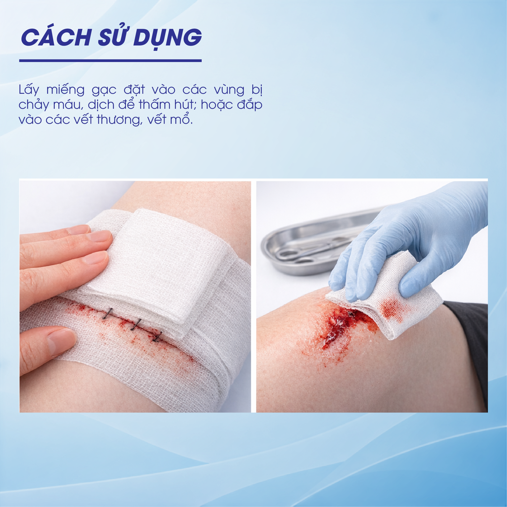 Gạc phẫu thuật BH245203 1