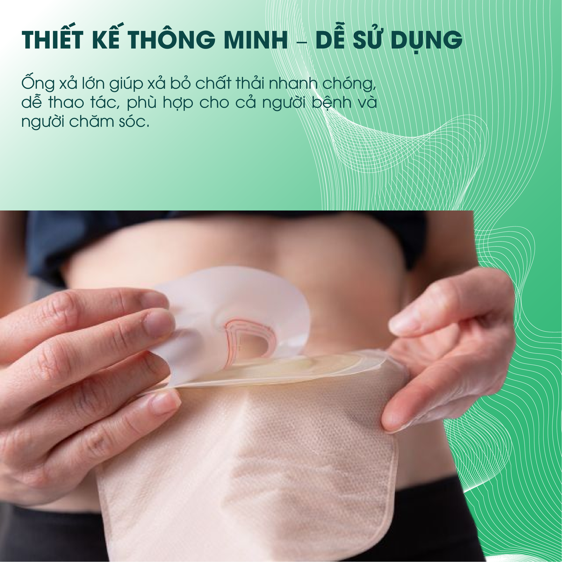 Túi Hậu Môn SOFTOMY BH245170 2