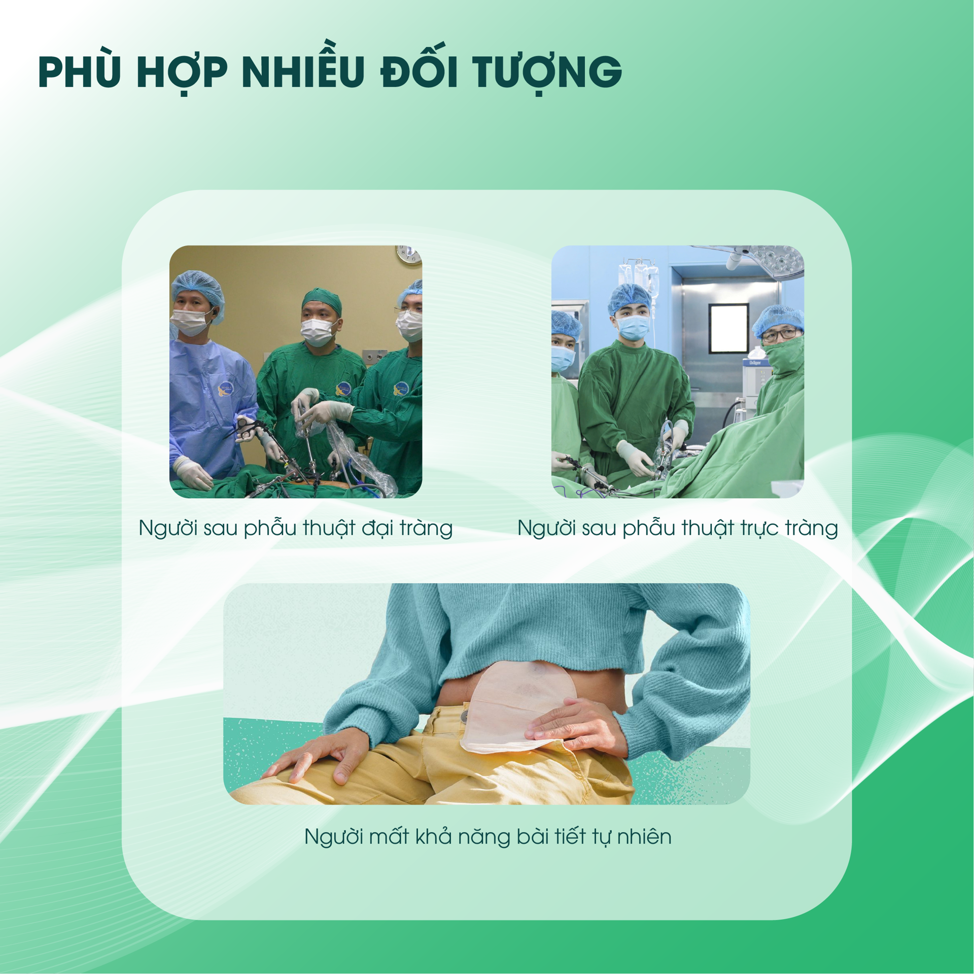 Túi Hậu Môn SOFTOMY BH245170 4