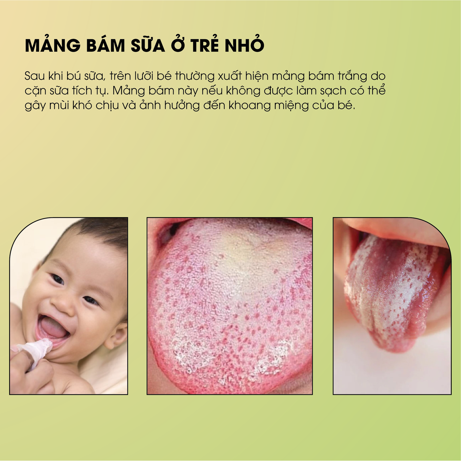 Rơ Lưỡi Y Tế Trẻ Em TANAPHAR BH245196 1