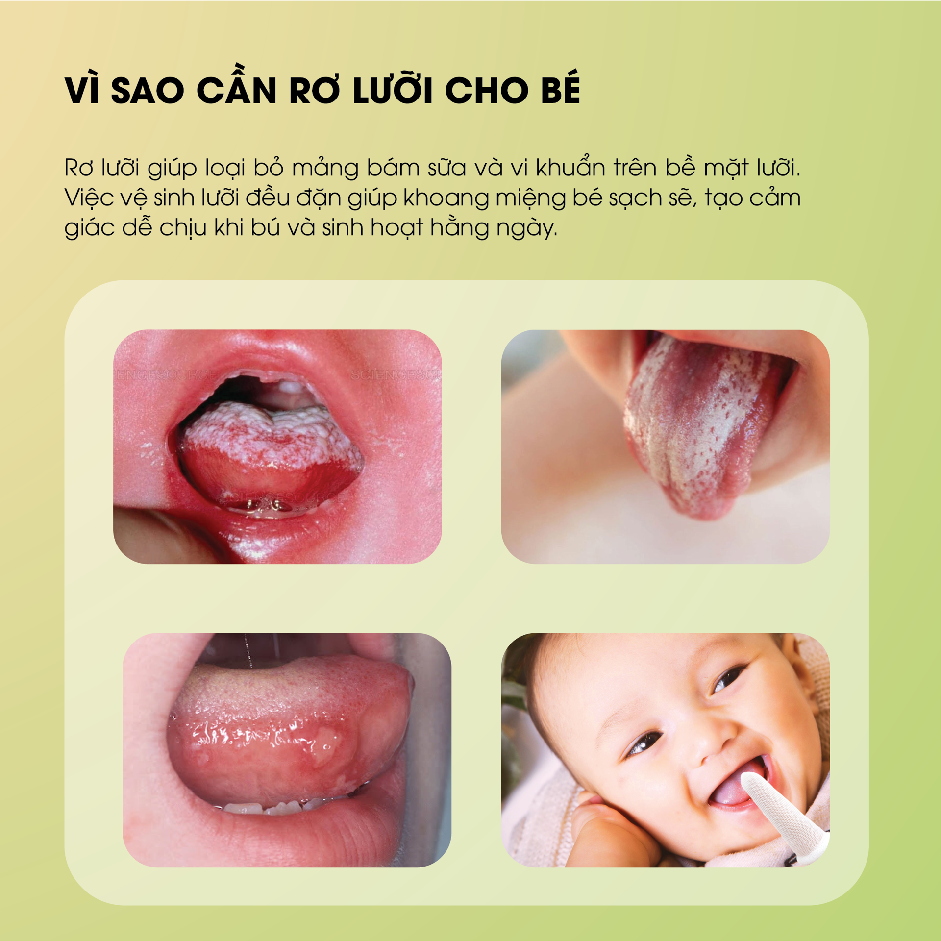 Rơ Lưỡi Y Tế Trẻ Em TANAPHAR BH245196 2