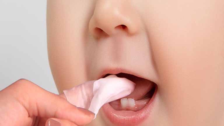 Mẹo rơ lưỡi mọc răng không sốt cho bé hiệu quả
